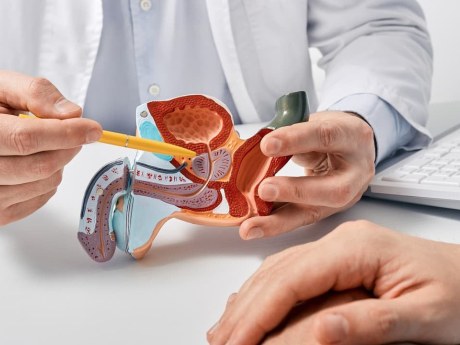 Rakovina prostaty: Zdravšie tuky môžu súvisieť s dlhším životom